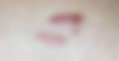 玉溪市人民医院皮肤医学美容外科医生名单和介绍