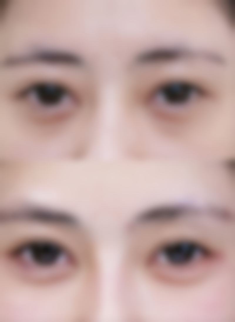 美南华医院收费标准