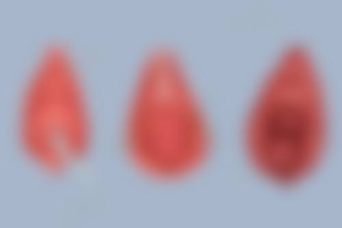 擅长多种手术方式