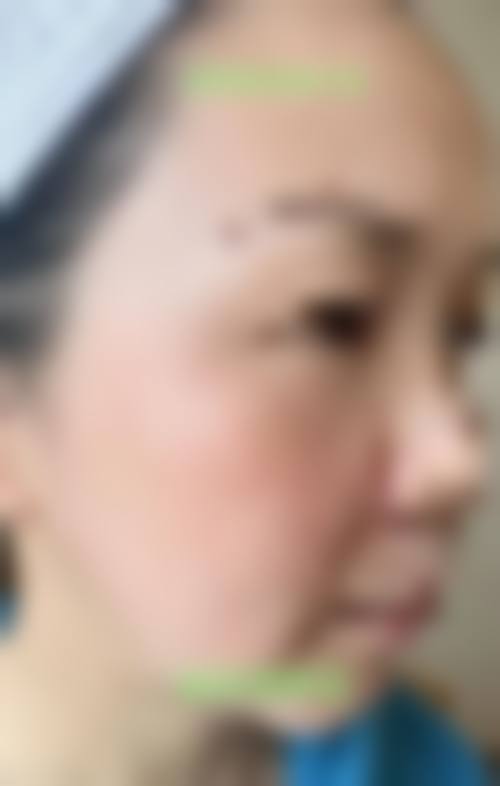 张琴真医生口碑评价及真人实例