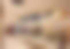 五、北京米兰柏羽丽都医疗美容全切双眼皮手术实例展示