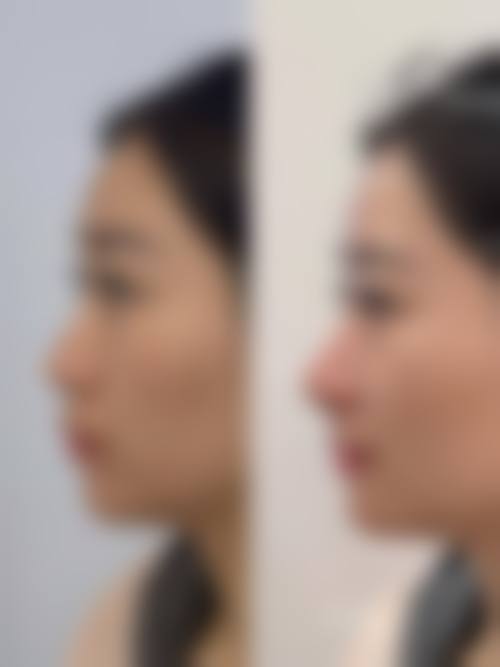 河南科技大学第一附属医院(烧伤整形外科)真实实例