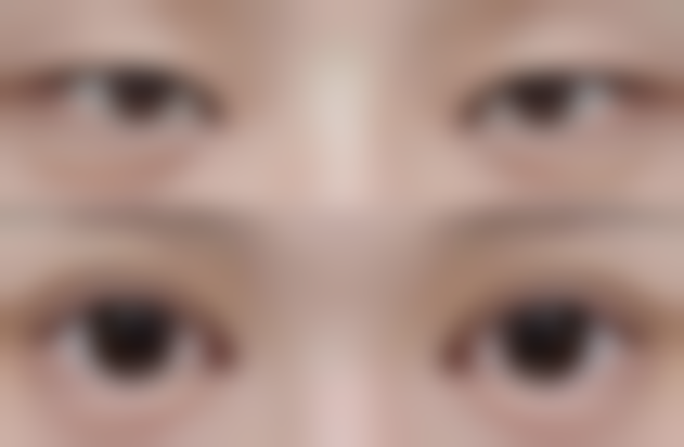 术后同房过早的危害：不可小觑的风险