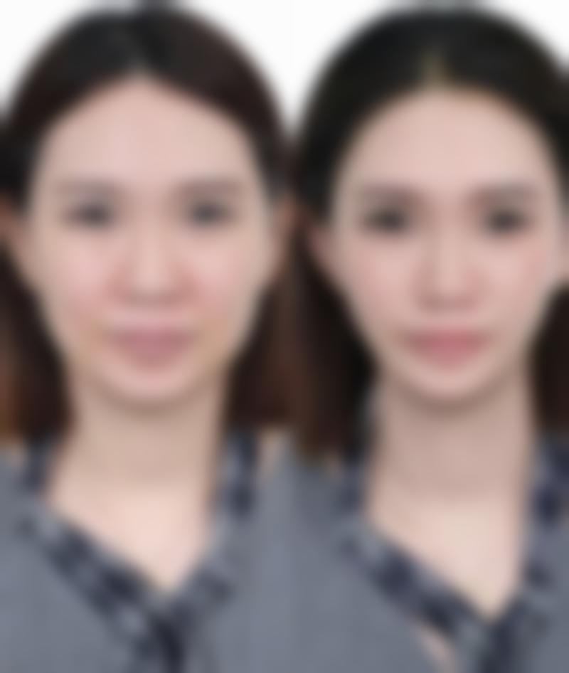 饮食调整:从内部调养眼部状态