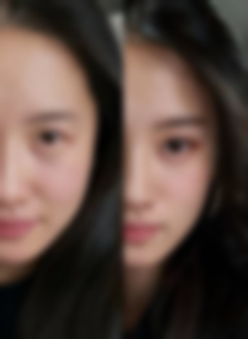 华颜美手术成效与口碑