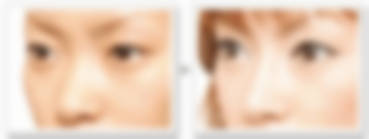 姜敏赫院长技术优势