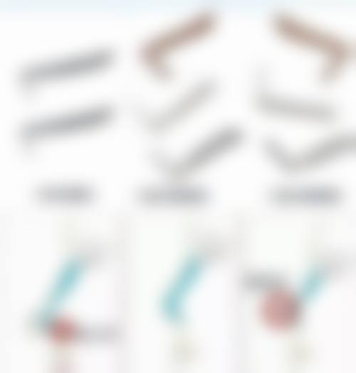 怎么可以让三眼皮变回双眼皮？可依病因选手术或非手术法，日常护理也能辅助改善！ 