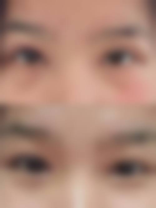 医生团队:经验多技术不错