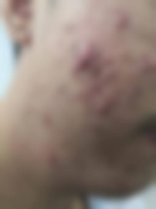 祛斑项目价格区间