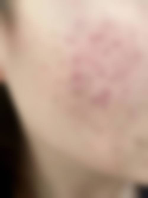 选择合适医院的建议