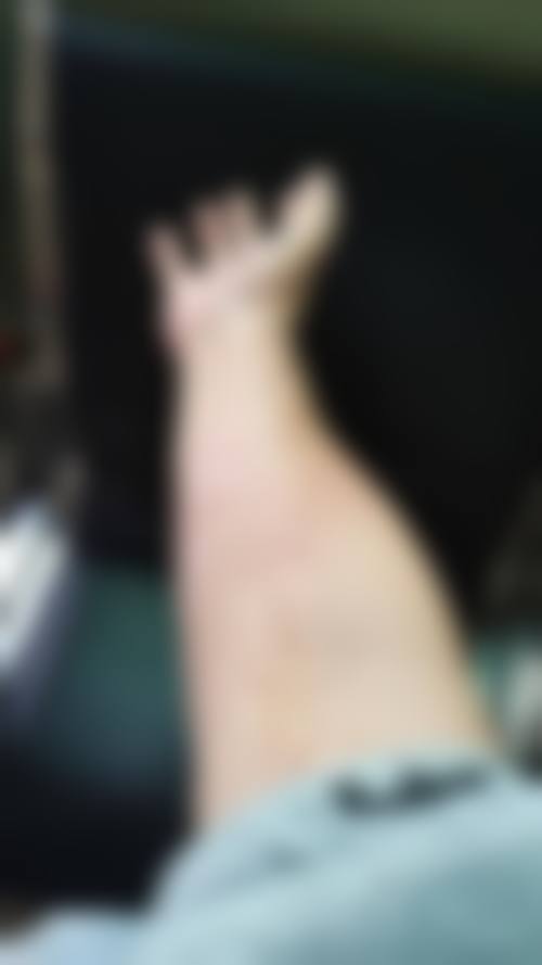 西安脱毛好的医院排行前六，西安美莱、艺星等医院，冰点无痛技术+良好口碑值得选！ 