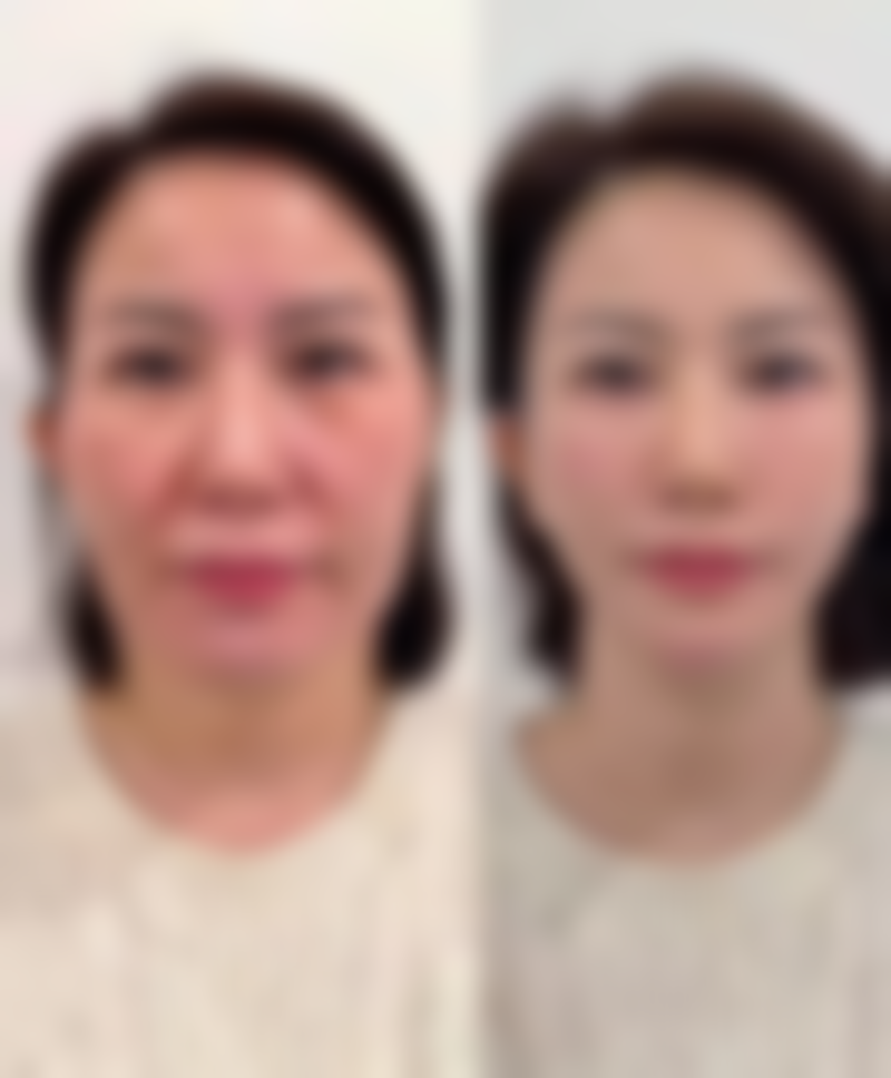 三、郑州安佳医学美容诊所核心技术与诊疗优势