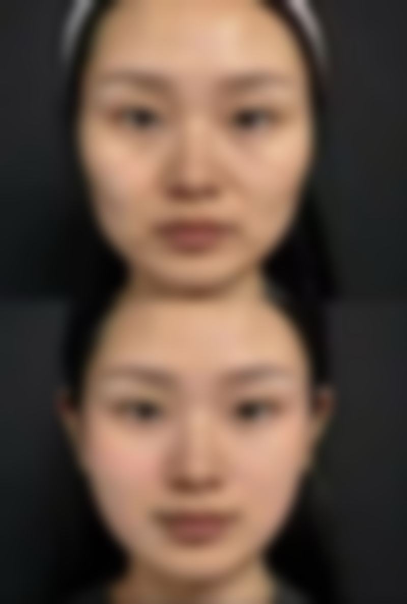 珂润润浸保湿眼膜：敏感肌的贴心之选