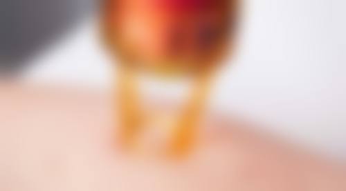 非手术治疗：温和祛除脂肪眼袋的选择