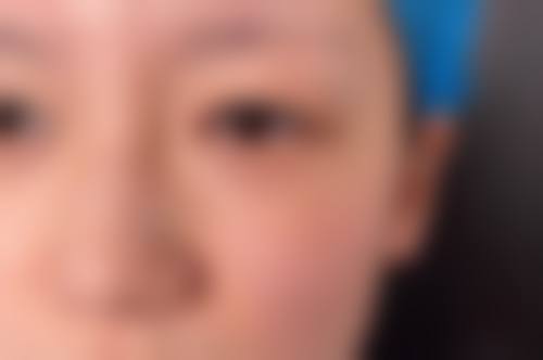 广州市番禺区妇幼保健院(皮肤美容科)患者常见问题解答