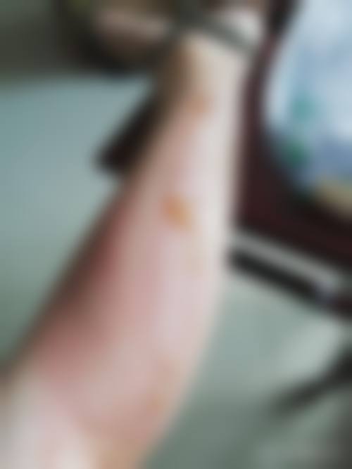 广州市番禺区妇幼保健院(皮肤美容科)是国有的吗？