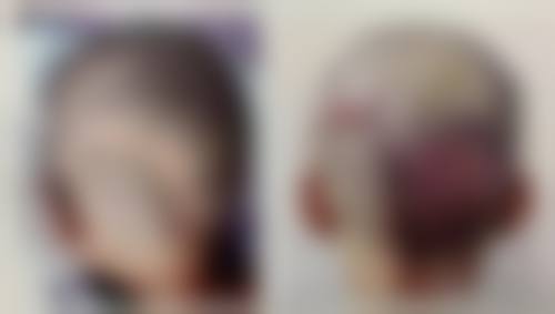 北京大麦微针植发医院医生团队介绍