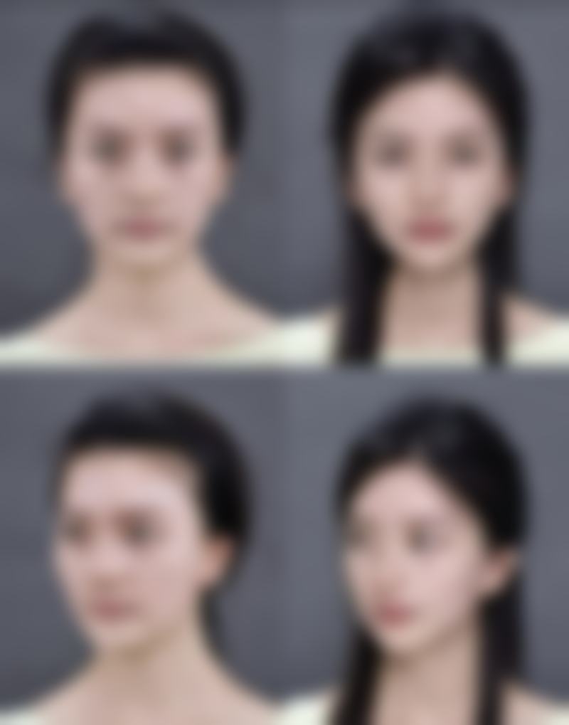 别慌！外切双眼皮修复异常应对小妙招