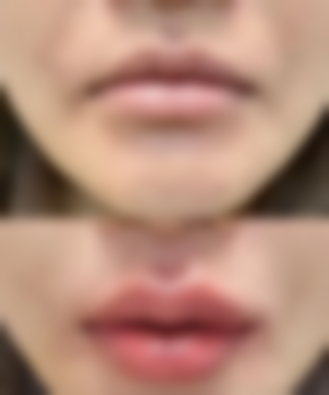 长沙瑞澜医疗美容医院