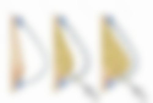 祛疤注意事项：选对方法，做好护理