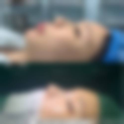 东莞长安环球美天整形医院怎么样？