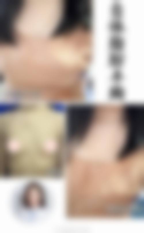 东莞长安环球美天整形医院正规可靠吗？