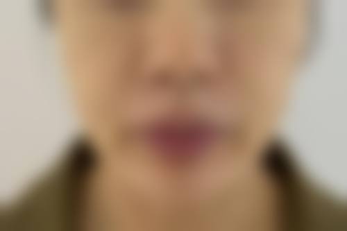 东莞玛利亚中韩整形医院价格表 / 收费标准一览