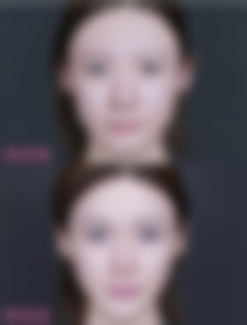 二、北京米兰柏羽丽都医疗美容半恒久纹唇项目详情