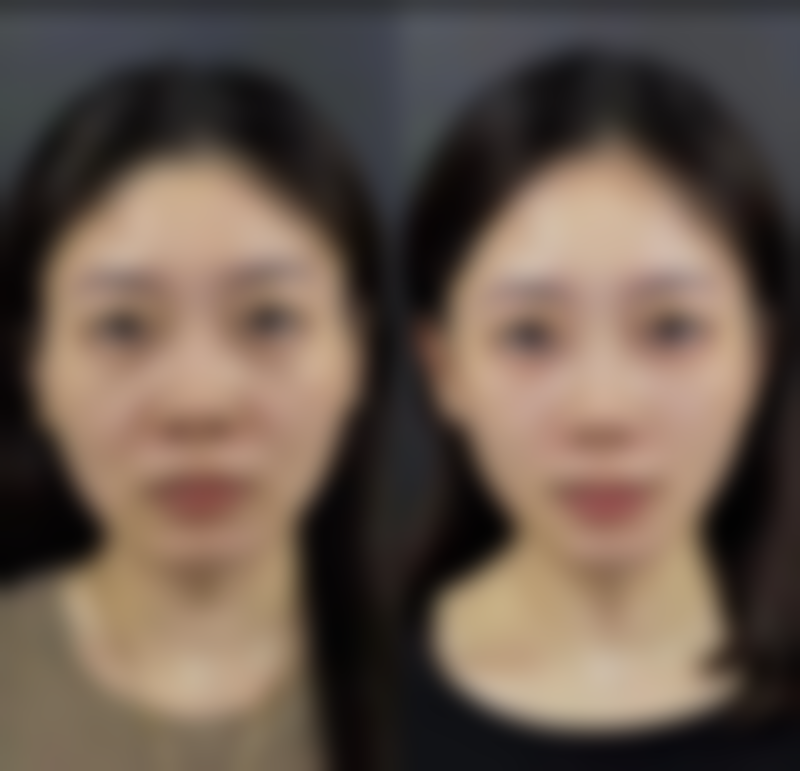 因缺少吕京陵医生相关具体信息，暂时无法生成满足要求的标题，请你提供吕京陵医生所在医院、相关评价、擅长项目等内容。 