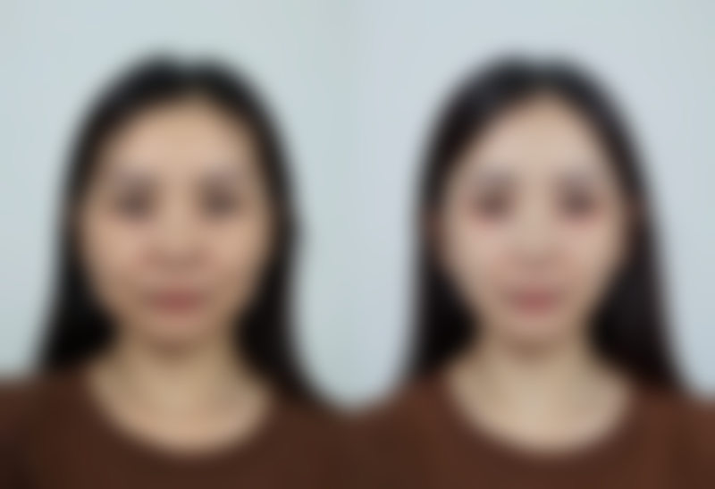 八、景德镇圣嘉丽整形医院真人口碑评价怎么样？