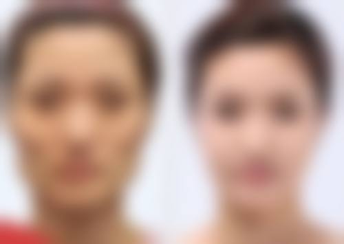 应对不对称情况:观察与修复手术