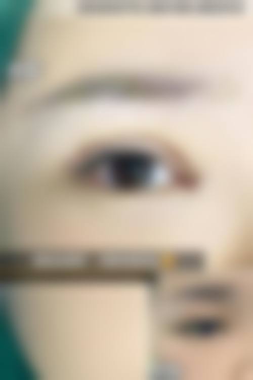 艺星的双眼皮医生团队