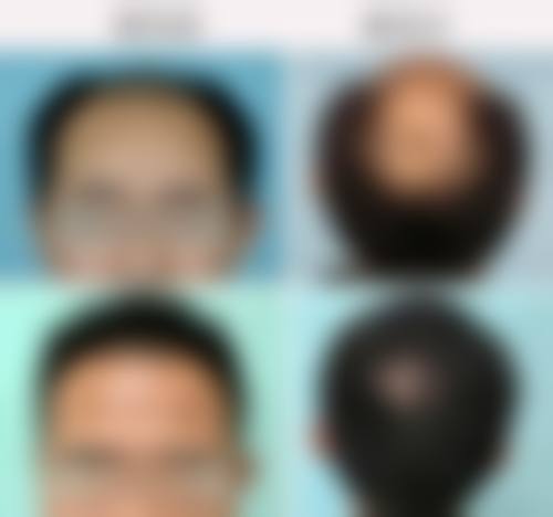 成都欧诺森整形医院详细的预约挂号方式及流程