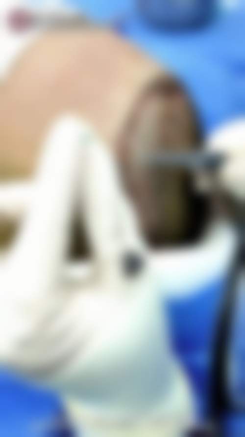 渠强医生擅长项目