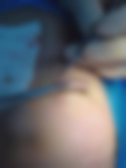 成都欧诺森整形医院收费价格表/收费标准