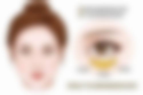 5D不开刀去眼袋与其他去眼袋方法的对比优势