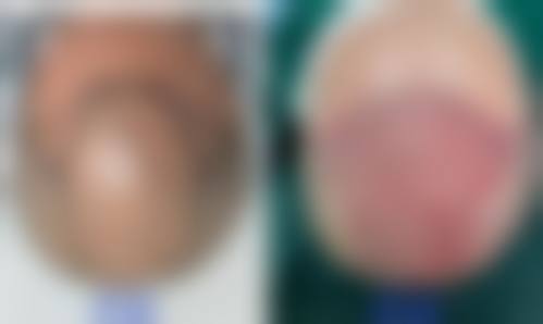 患者常见问题解答（精选）