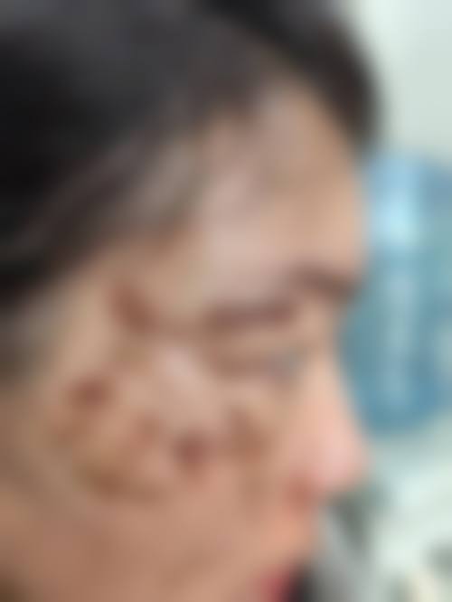 2026惠州整形医院排名前十揭晓，鹏爱、时光上榜，眼部整形3000 - 10000元！ 