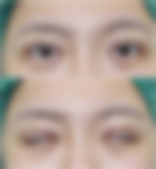 手术成效令人满意