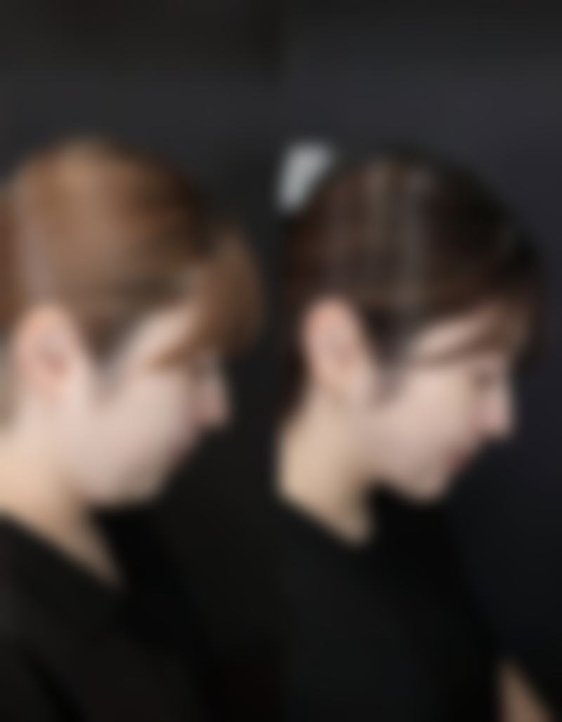 借助医美手段，快速改善眼袋发黑