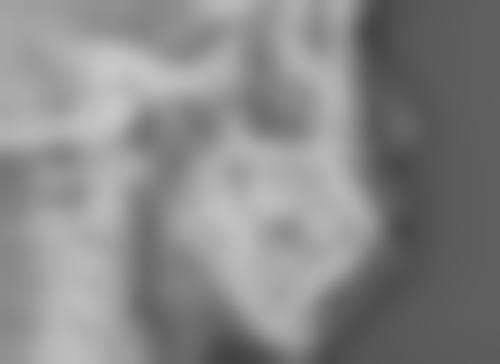 选择建议：找到更适合你的手术