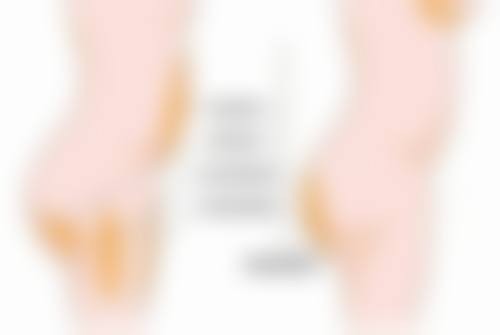 新疤痕激光治疗的实例分享