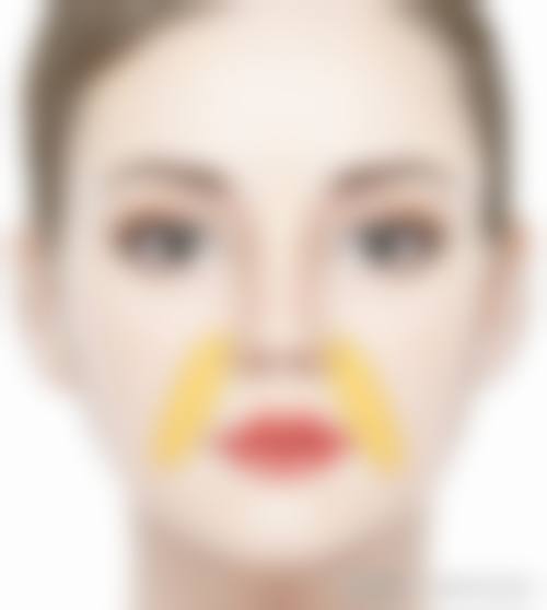 激光治疗新疤痕的成效受哪些因素影响