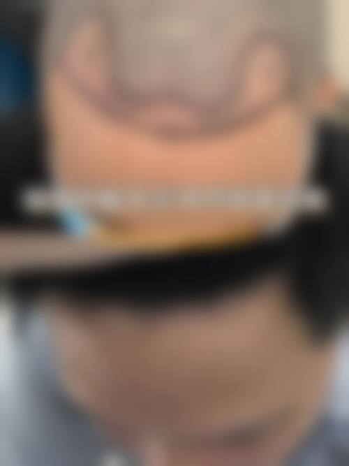 北京晶美医疗美容诊所真人口碑评价怎么样?