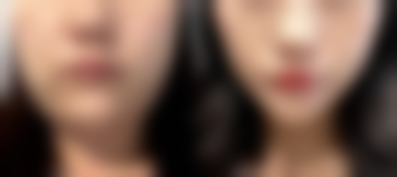 杭州君曼医疗美容会所收费价格表/收费标准