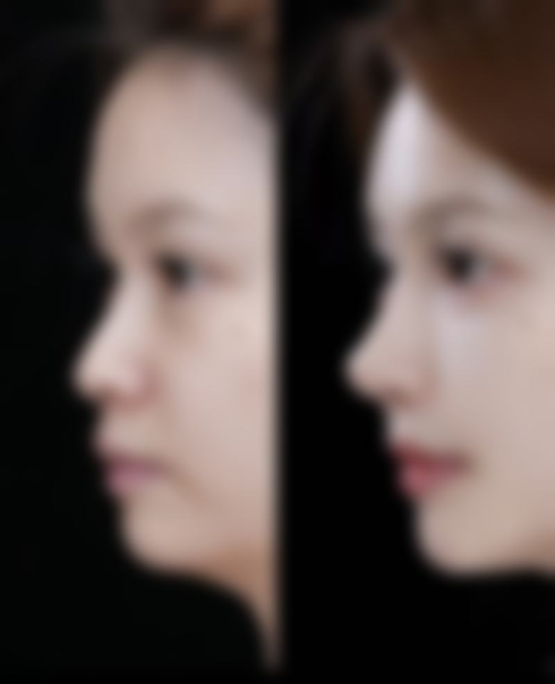 山东省立医院整形美容科专家谁最好？霍然、胡振生技术精湛，口碑好，电话 0531 - 8793xxx 