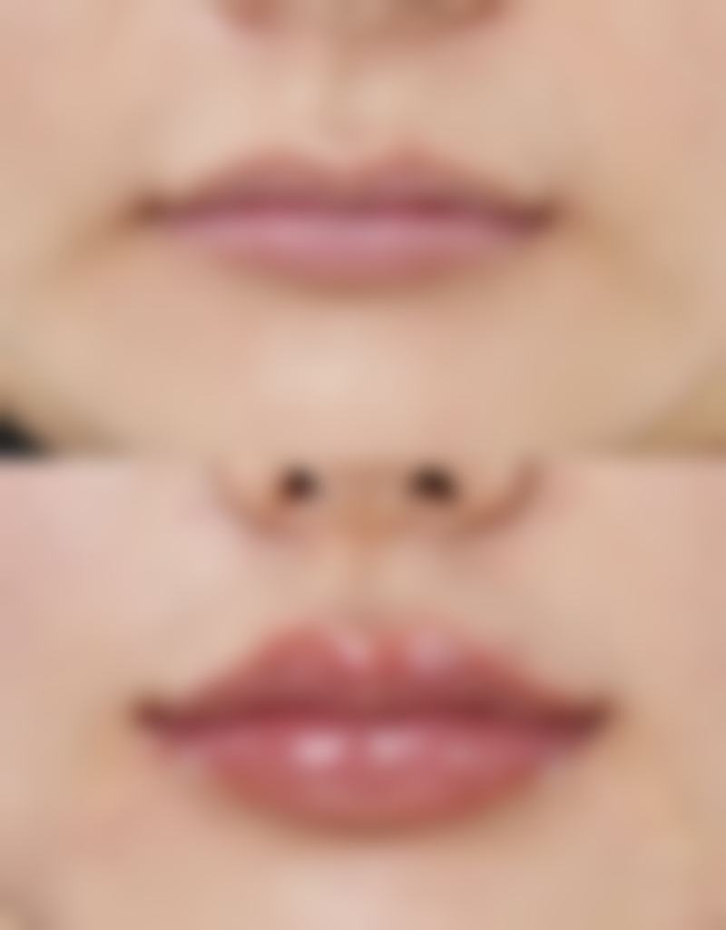 哪些新疤痕适合激光治疗