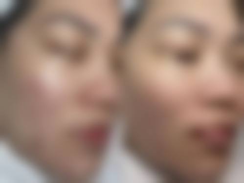 医院的真人实例