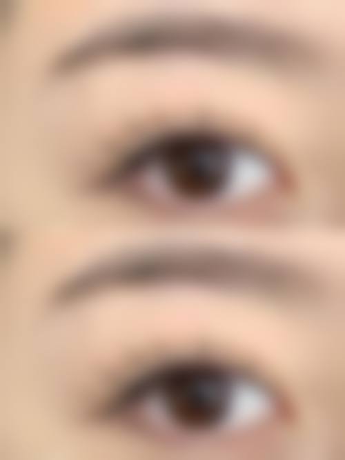 七、抚顺陈彩蓓整形医院常见问题解答