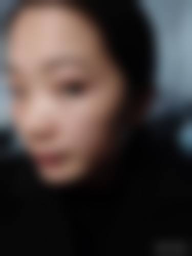 北大第一医院激光美容价目表(收费明细)近期更新发表，雀斑1000 - 3000元/次，设备先进口碑好！ 